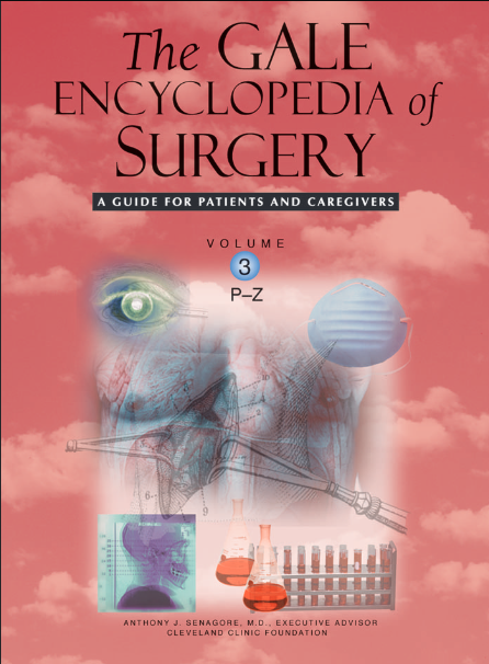 The Gale encyclopedia of surgery: a guide for patients and caregivers volume 3